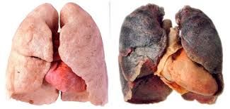 20201208103104lungs2.jpg